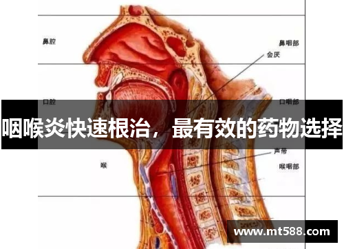 咽喉炎快速根治，最有效的药物选择